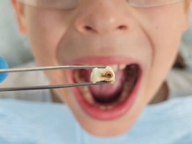Best Emergency Dentist Open Today  in Nashville, NC